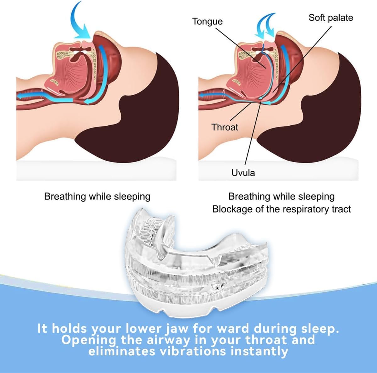 Anti Snore Mouth Guard, Adjustable Anti Snoring Device, Effective Stop - M&M